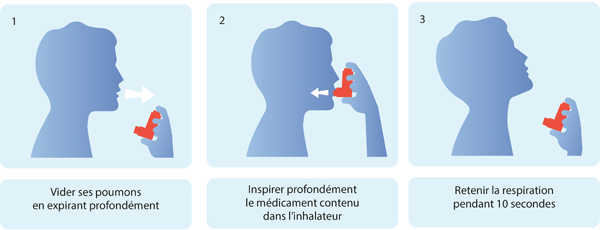 Il est très facile d'utiliser un bronchodilatateur, si on a la bonne technique!
