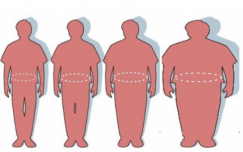 les différentes obésité existantes